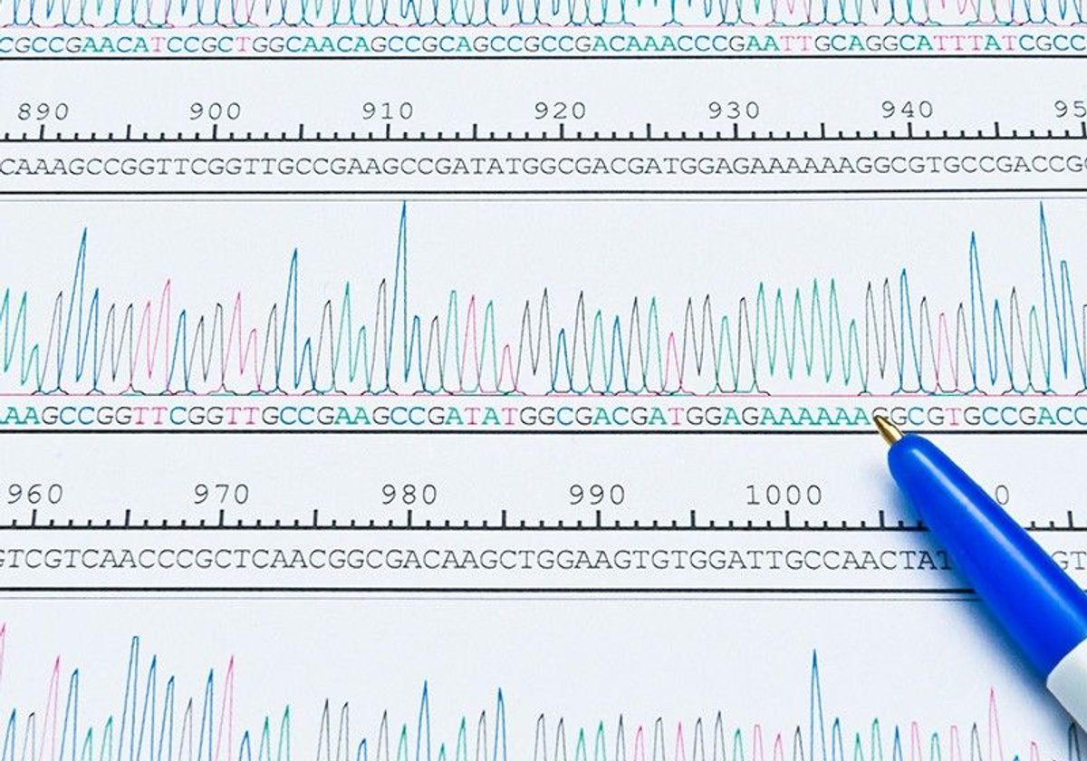 Chromatogram peaks of a DNA sequencing analysis.