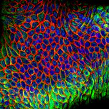 Image of pancreatic organoids under a microscope with immunofluorescent staining