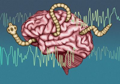 a Taenia solium parasite, a human brain, and lines that represent an electroencephalogram (EEG) recording.