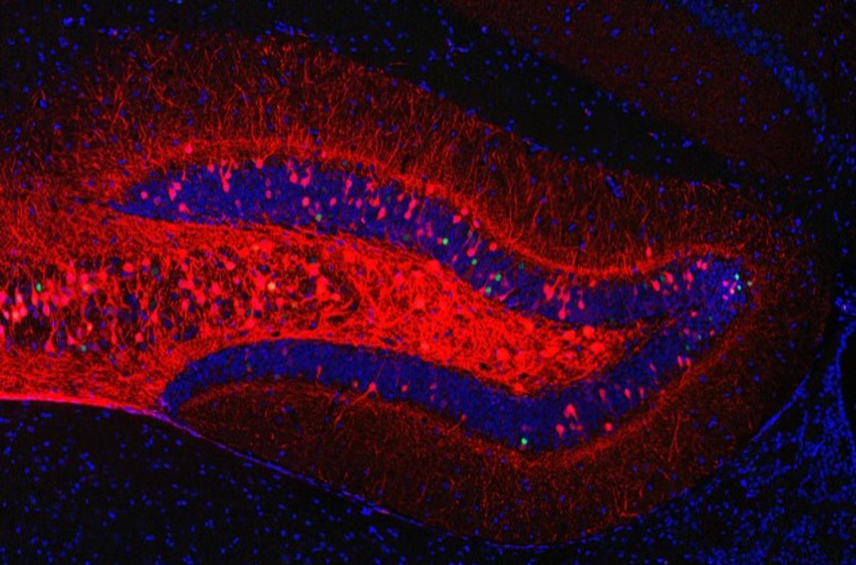Red, green, and blue fluorescently labeled neurons in a portion of the mouse hippocampus.