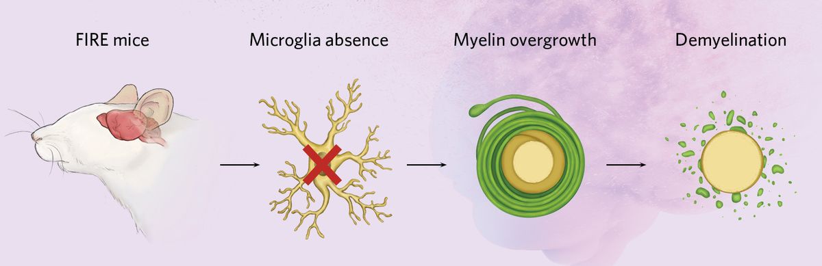 Infographic showing how the lack of microglia causes myelin overgrowth and eventual degeneration.
