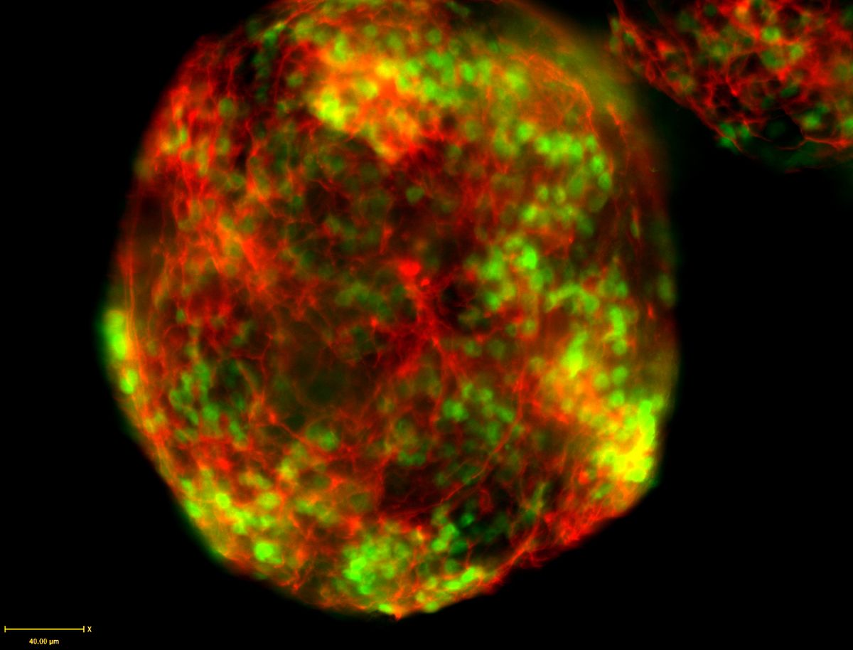 Red fluorescing neurons form a spiderweb-like sphere across mouse embryonic stem cells, where some cells are also expressing green fluorescent protein (GFP).