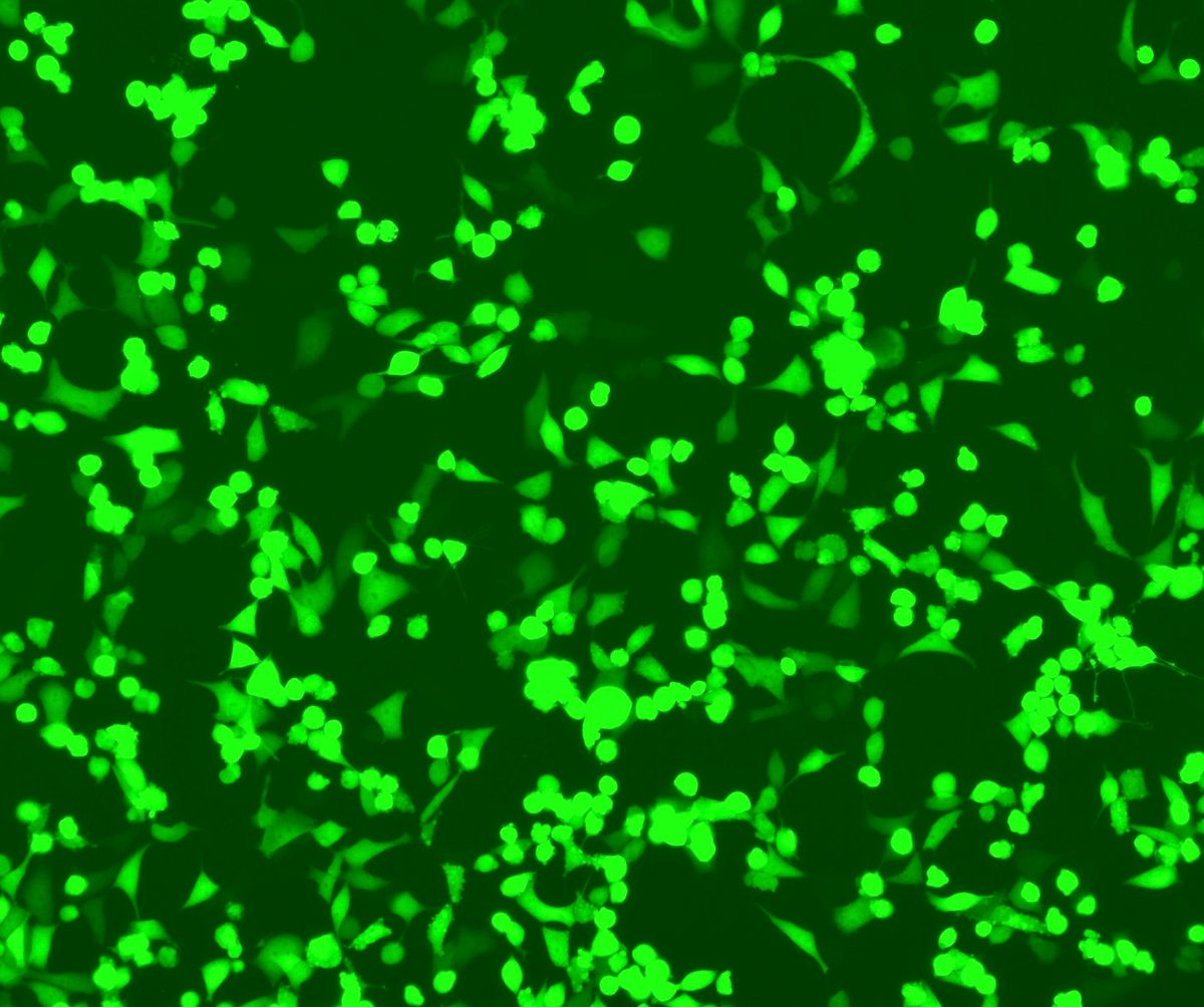 Fluorescent microscopy image of mammalian cells expressing bright green GFP.