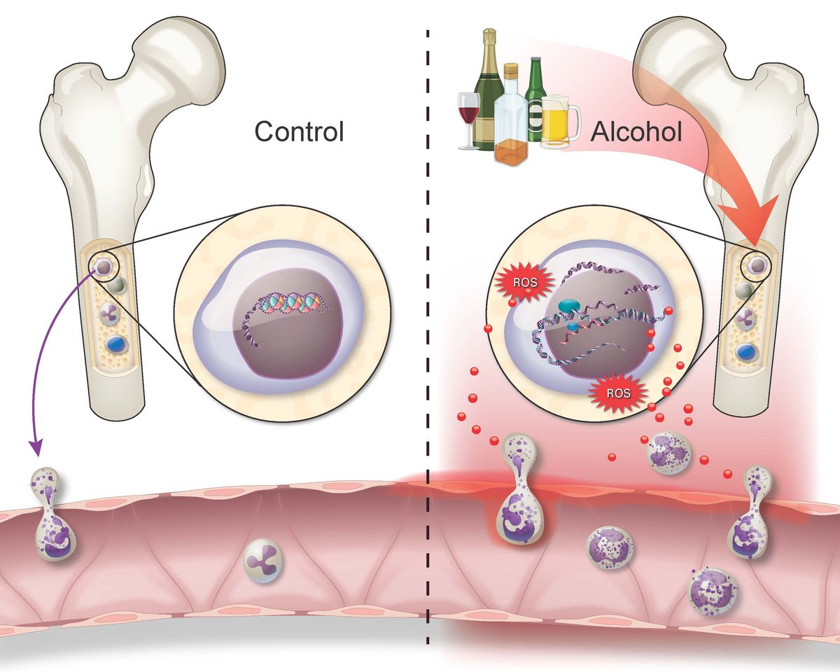 A schematic showing alcohol’s effects on bone marrow stem cells driving inflammation through changes to DNA accessibility.