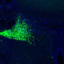 GFP highlighting mouse neurons