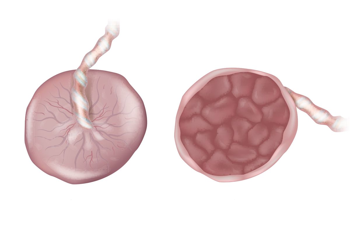 Medical illustrations of the fetal and maternal placental surfaces.