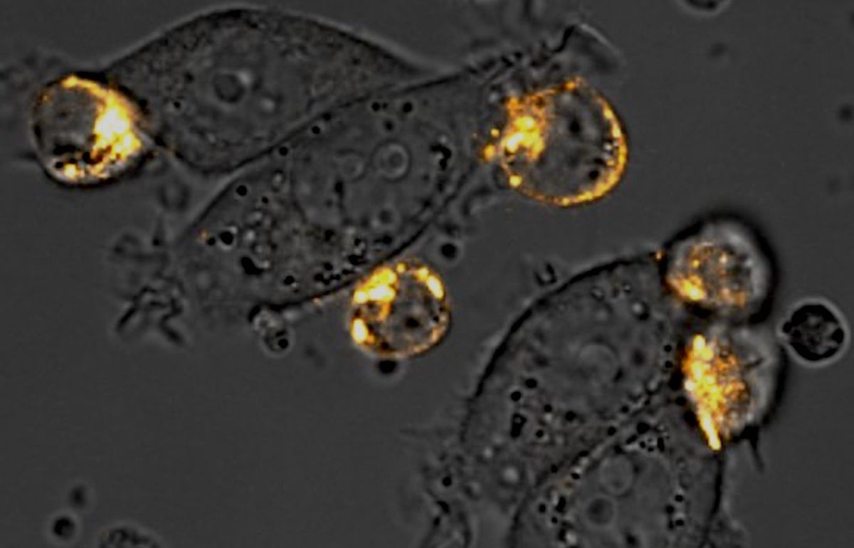 Microscopy image showing orange circles attached to grey, oblong cells.