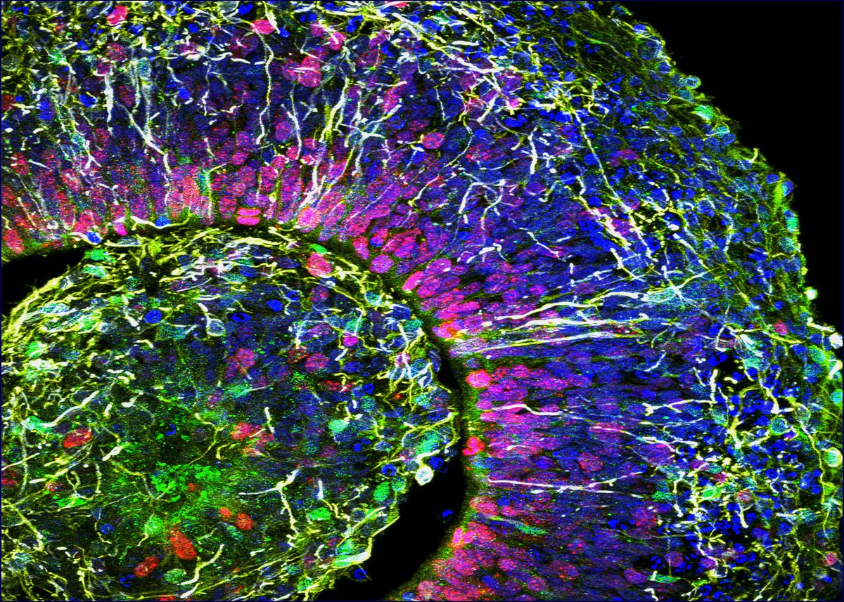 A microscopy image of a fluorescently stained brain organoid, demonstrating complex cellular heterogeneity with cells stained using different colored markers.