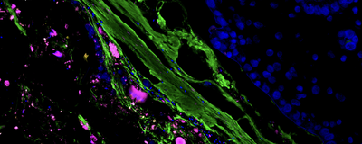 An image of part of a mouse distal colon showing luminal contents with bacteria in magenta, the mucus lining (green) and the epithelial cell barrier of the gut (blue, right).