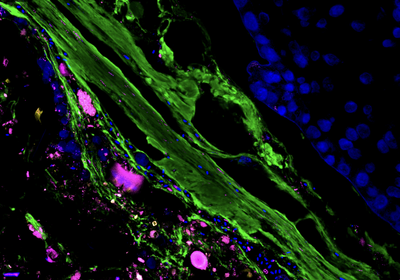 A section of a mouse distal colon showing luminal contents with bacteria in magenta, the mucus lining (green) and the epithelial cell barrier of the gut (blue, right).