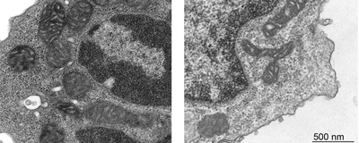 Grey TEM image show mitochondria and organelles between two groups of T cells