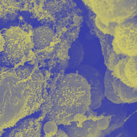 A scanning electron micrograph of a fetal gut, pseudocolored in yellow and blue