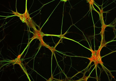 Confocal image of cortical neurons in culture
